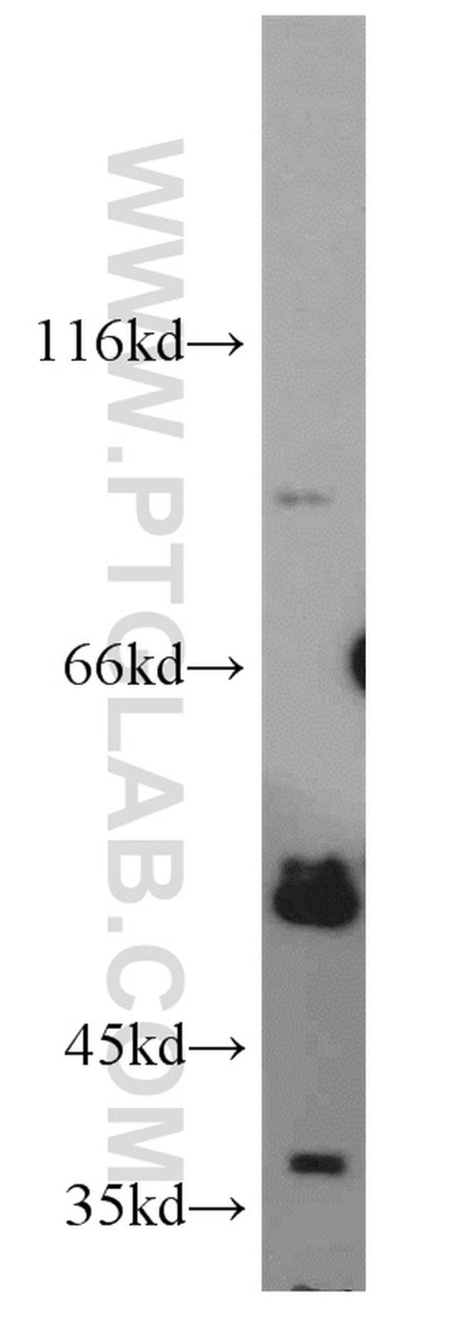 CABYR Antibody in Western Blot (WB)