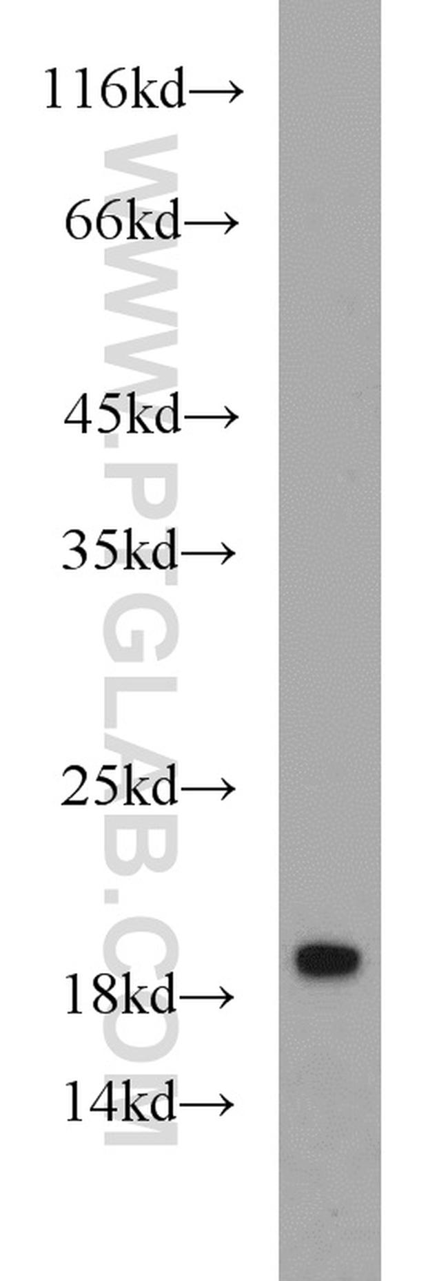 GILZ Antibody in Western Blot (WB)