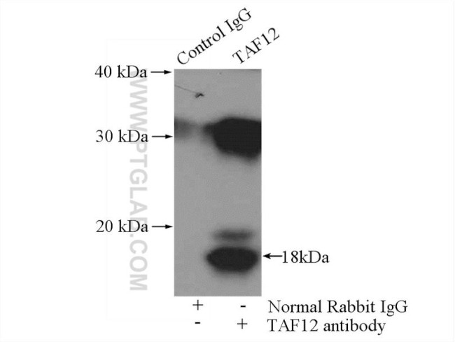 TAF12 Antibody in Immunoprecipitation (IP)