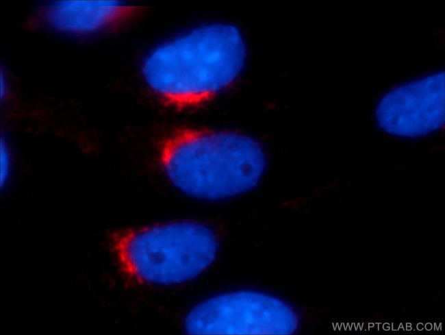 VTI1A Antibody in Immunocytochemistry (ICC/IF)