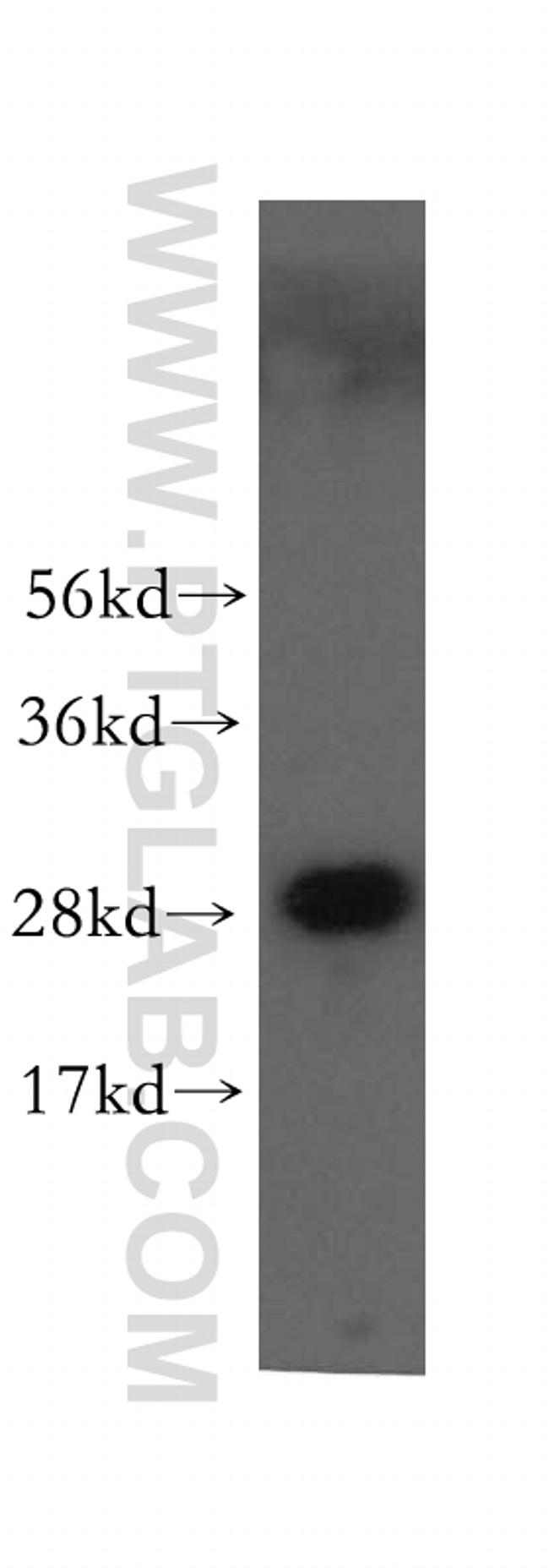 VTI1A Antibody in Western Blot (WB)