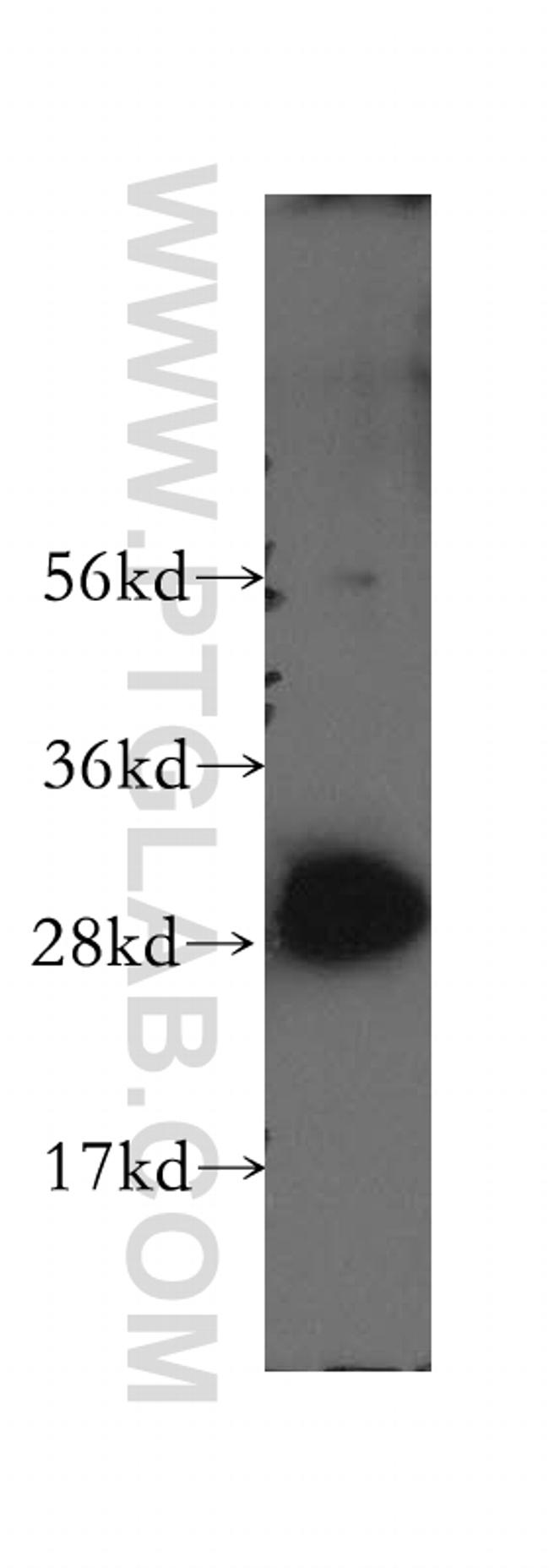 VTI1A Antibody in Western Blot (WB)