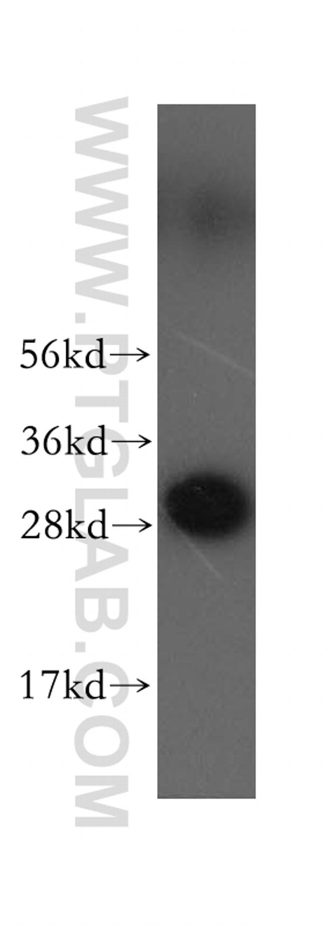 VTI1A Antibody in Western Blot (WB)