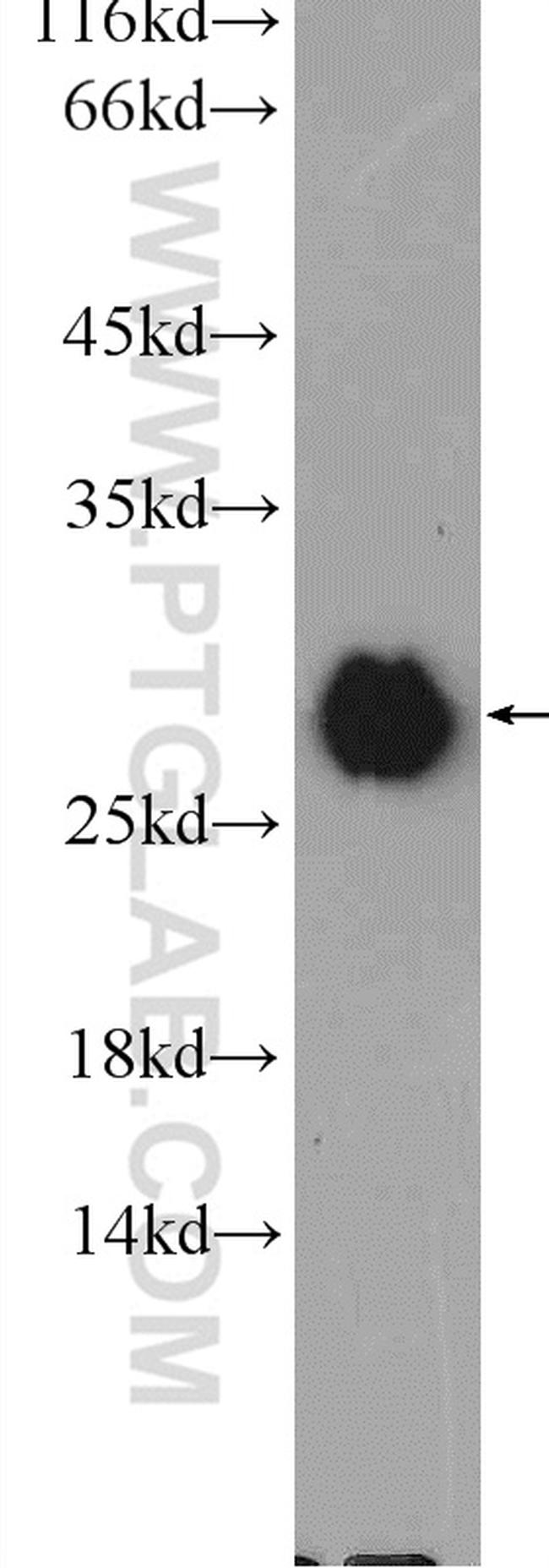 VTI1A Antibody in Western Blot (WB)