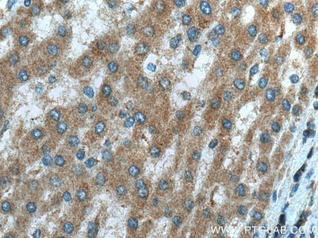 NDUFB3 Antibody in Immunohistochemistry (Paraffin) (IHC (P))