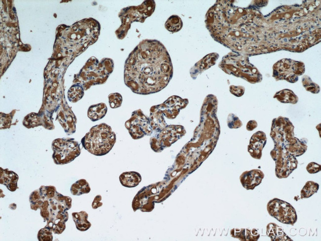 Hemoglobin epsilon Antibody in Immunohistochemistry (Paraffin) (IHC (P))