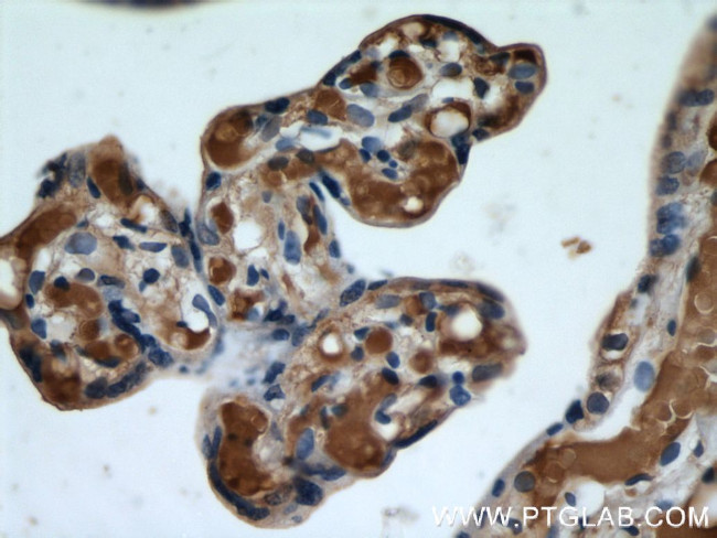 Hemoglobin epsilon Antibody in Immunohistochemistry (Paraffin) (IHC (P))