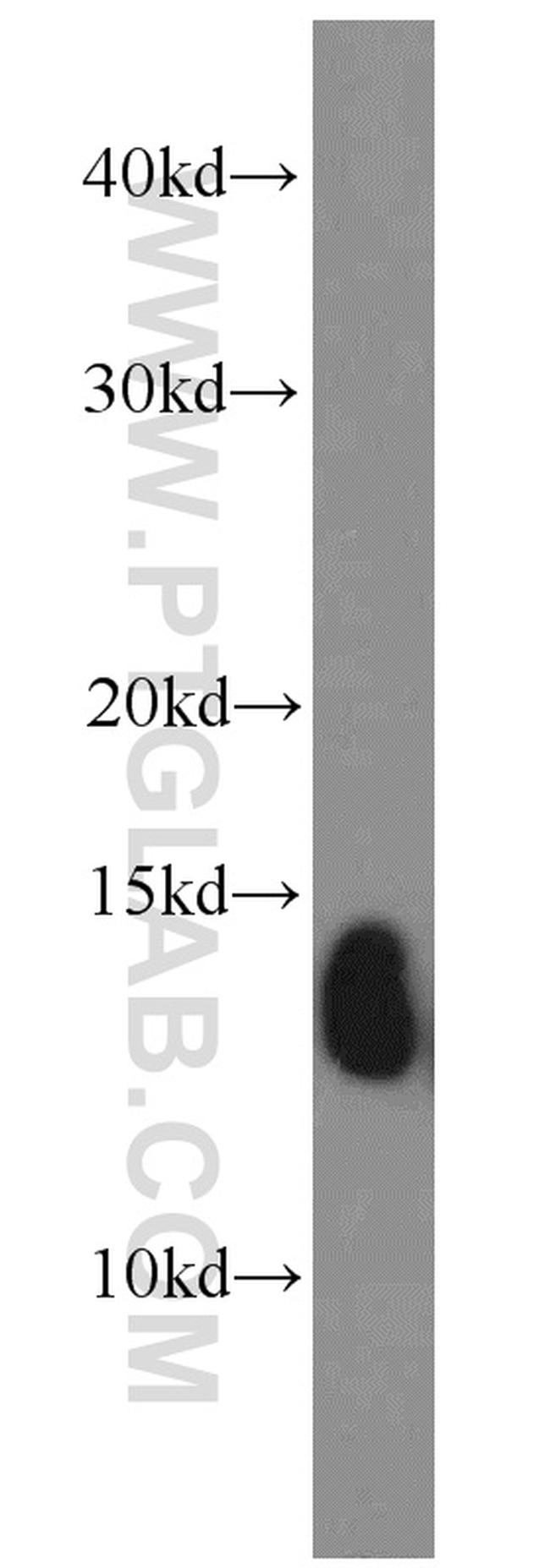 Hemoglobin epsilon Antibody in Western Blot (WB)