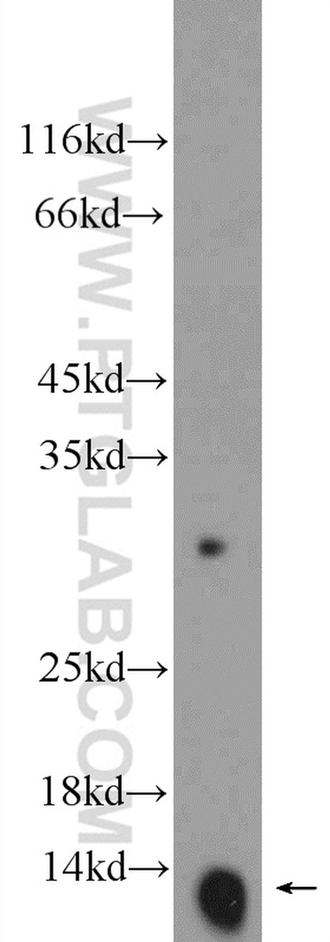 Hemoglobin epsilon Antibody in Western Blot (WB)