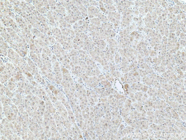 DNAJC1 Antibody in Immunohistochemistry (Paraffin) (IHC (P))