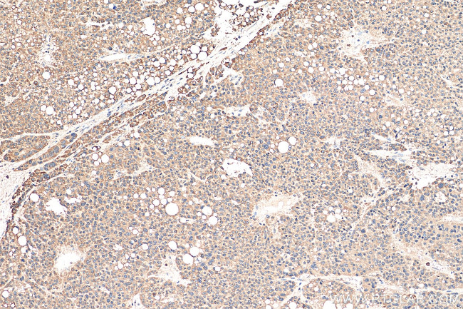 DNAJC1 Antibody in Immunohistochemistry (Paraffin) (IHC (P))