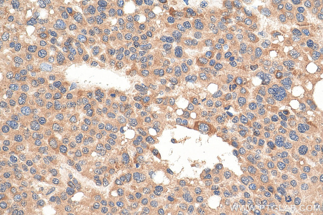 DNAJC1 Antibody in Immunohistochemistry (Paraffin) (IHC (P))