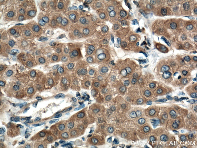 Cytochrome b5 Antibody in Immunohistochemistry (Paraffin) (IHC (P))