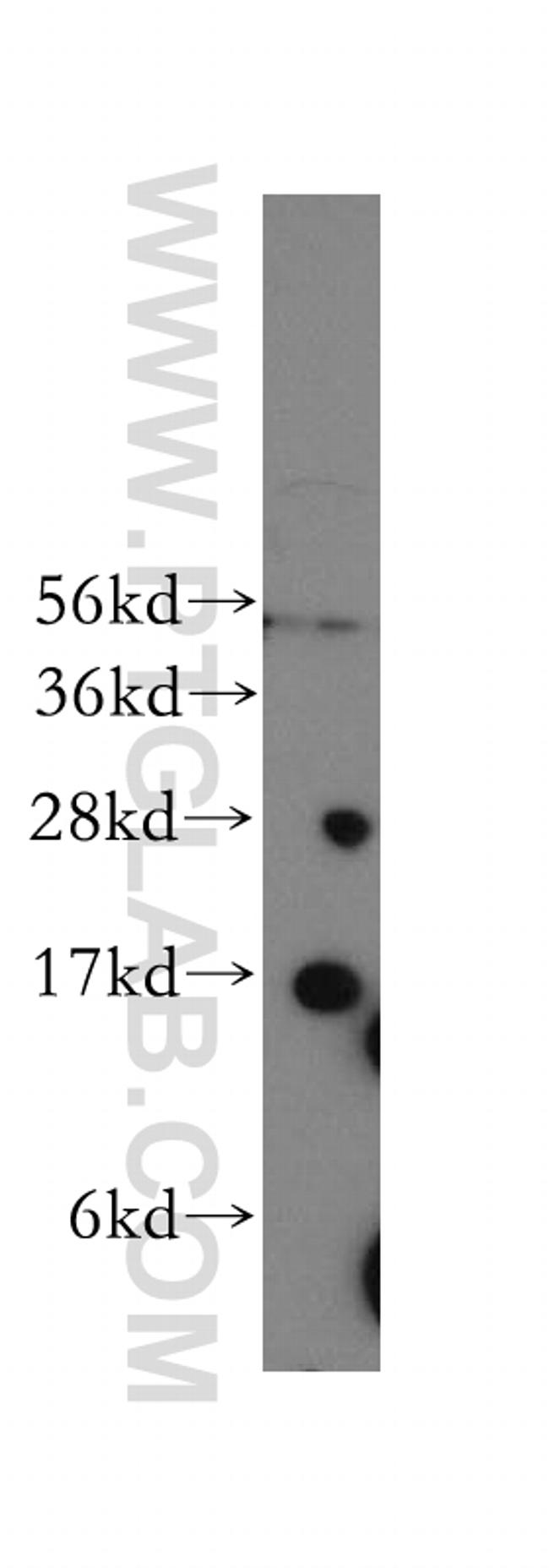 Cytochrome b5 Antibody in Western Blot (WB)