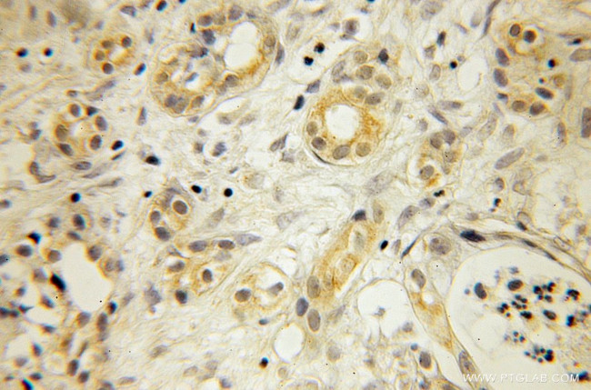 Cytochrome b5 Antibody in Immunohistochemistry (Paraffin) (IHC (P))