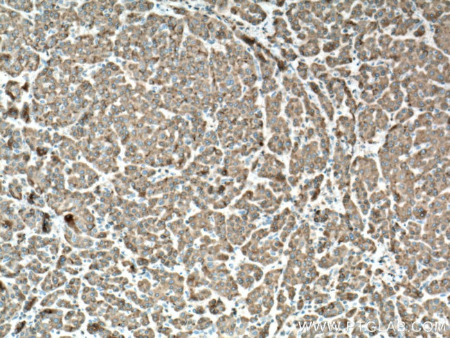 Cytochrome b5 Antibody in Immunohistochemistry (Paraffin) (IHC (P))