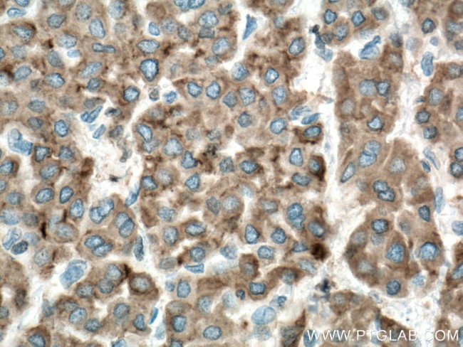 Cytochrome b5 Antibody in Immunohistochemistry (Paraffin) (IHC (P))