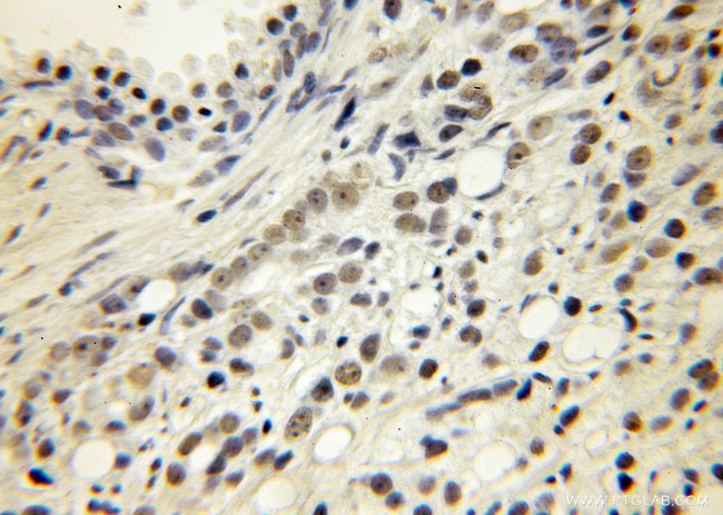 KPNA6 Antibody in Immunohistochemistry (Paraffin) (IHC (P))