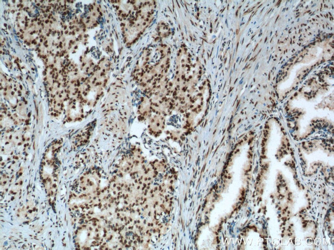 KPNA6 Antibody in Immunohistochemistry (Paraffin) (IHC (P))