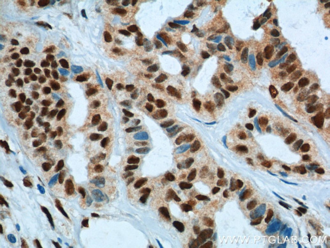 KPNA6 Antibody in Immunohistochemistry (Paraffin) (IHC (P))