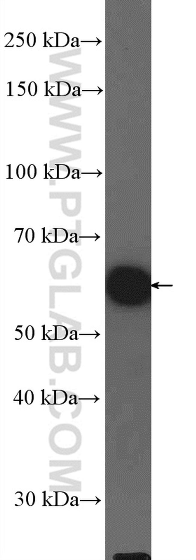 KPNA6 Antibody in Western Blot (WB)