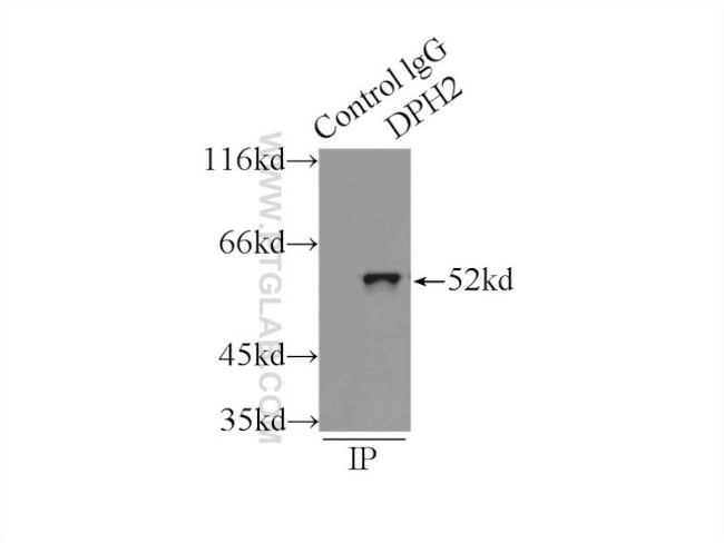 DPH2 Antibody in Immunoprecipitation (IP)