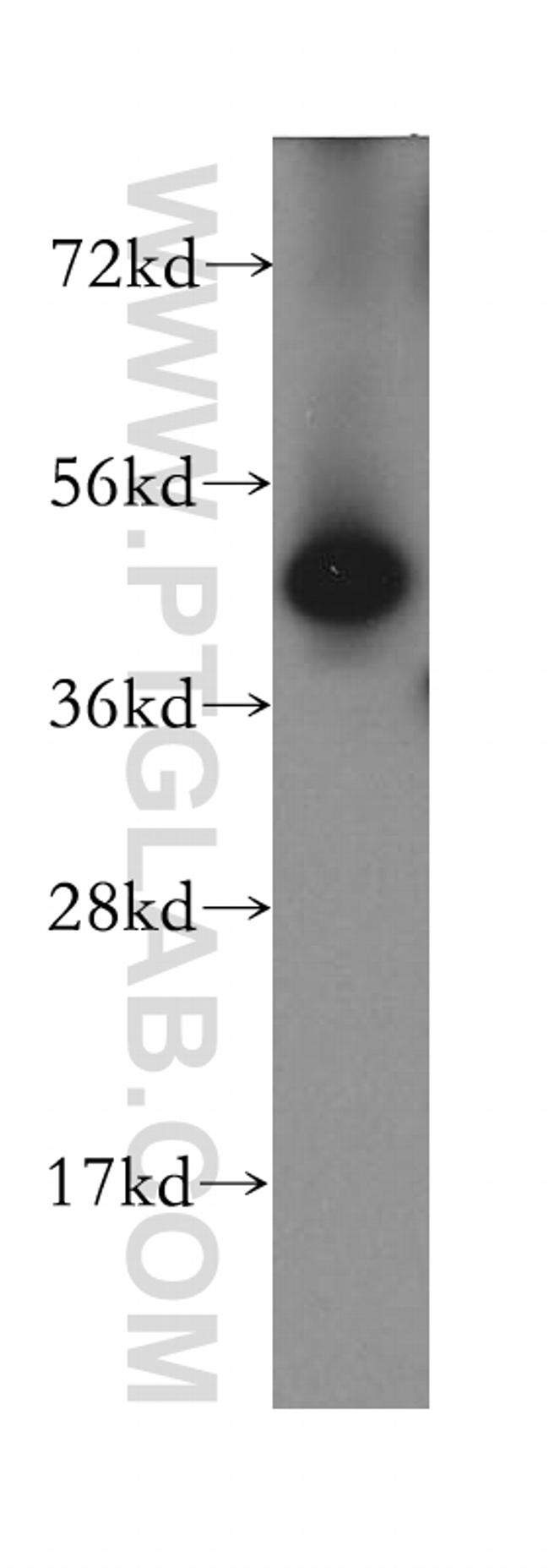 DPH2 Antibody in Western Blot (WB)