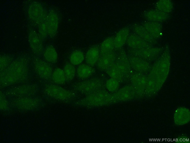 PINX1 Antibody in Immunocytochemistry (ICC/IF)