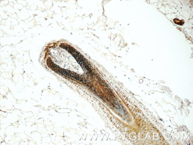 PINX1 Antibody in Immunohistochemistry (Paraffin) (IHC (P))