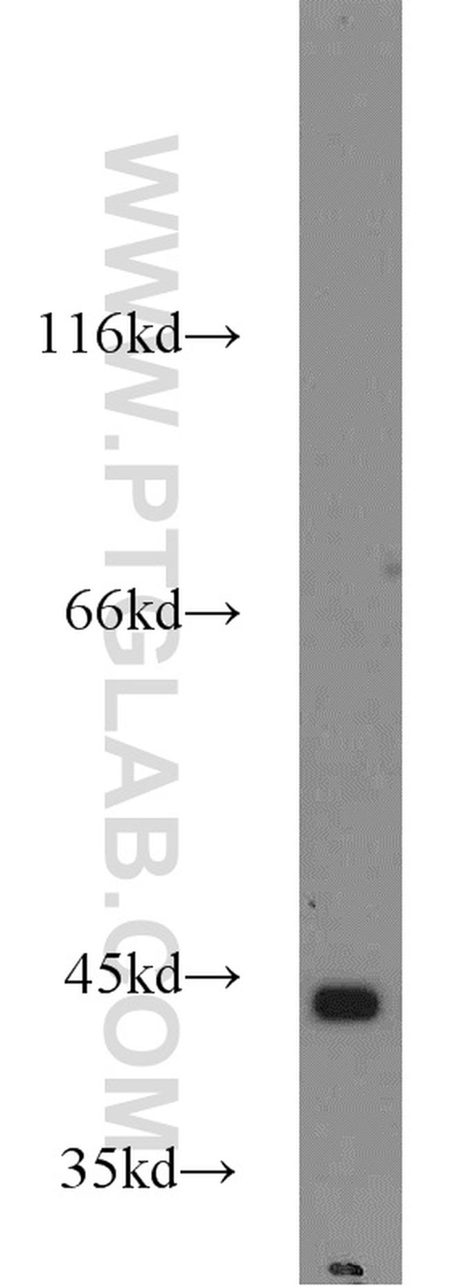 PINX1 Antibody in Western Blot (WB)