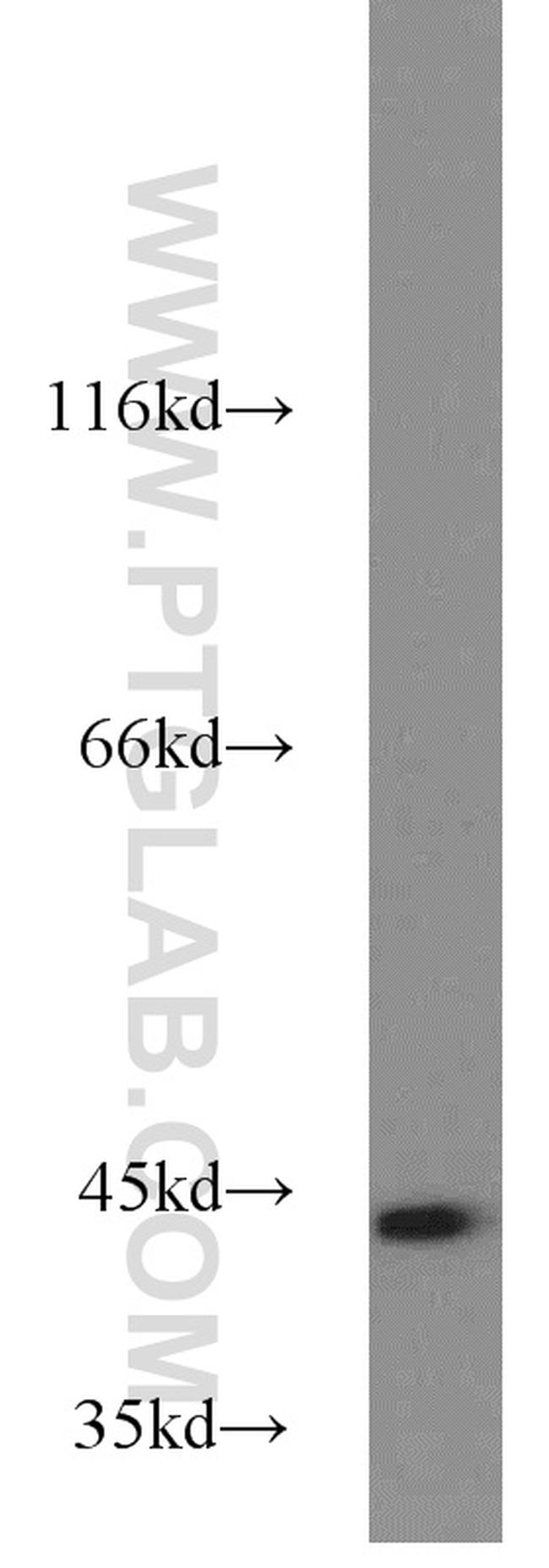 PINX1 Antibody in Western Blot (WB)