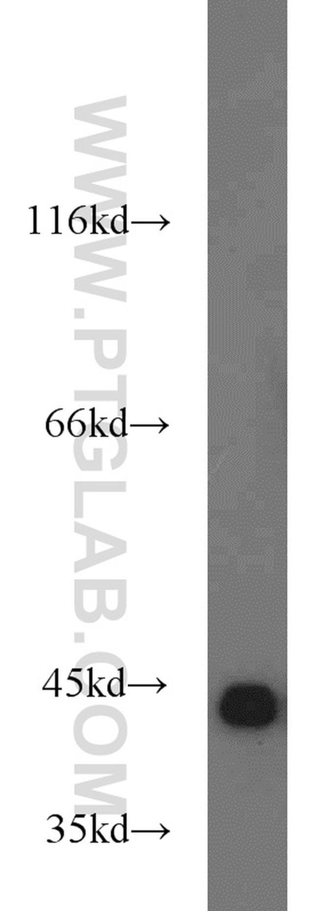 PINX1 Antibody in Western Blot (WB)