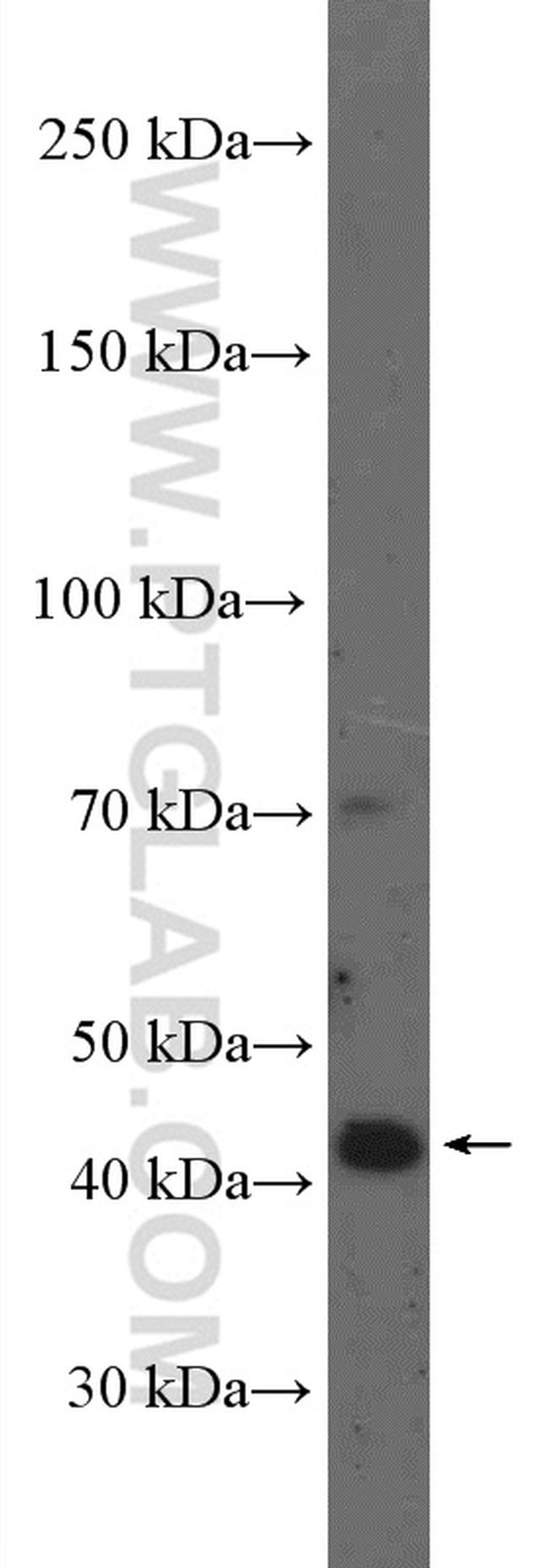 PINX1 Antibody in Western Blot (WB)