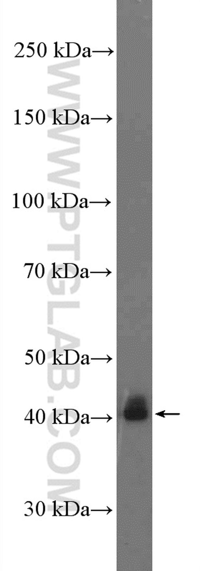 PINX1 Antibody in Western Blot (WB)