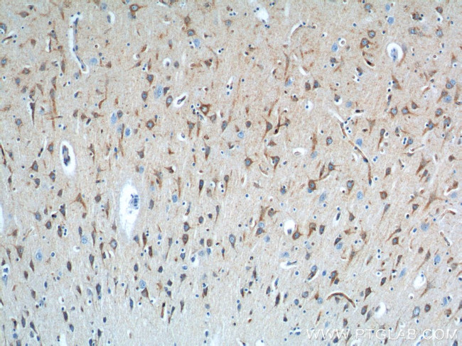 Sortilin Antibody in Immunohistochemistry (Paraffin) (IHC (P))