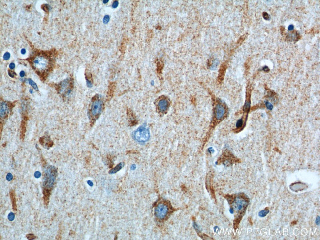 Sortilin Antibody in Immunohistochemistry (Paraffin) (IHC (P))