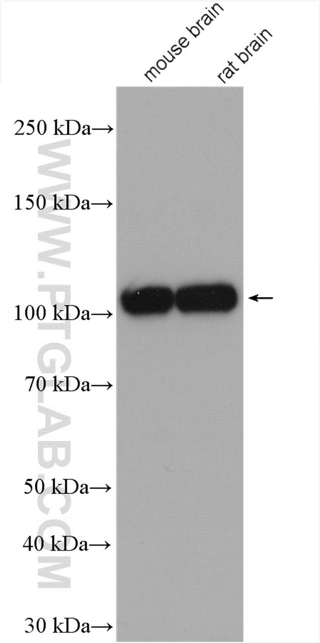 Sortilin Antibody in Western Blot (WB)