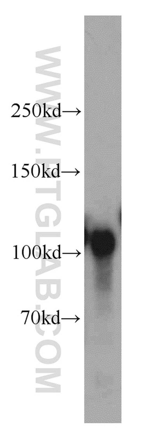 Sortilin Antibody in Western Blot (WB)