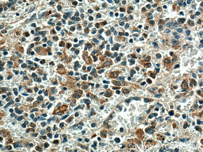 EBI3 Antibody in Immunohistochemistry (Paraffin) (IHC (P))