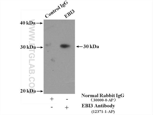 EBI3 Antibody in Immunoprecipitation (IP)