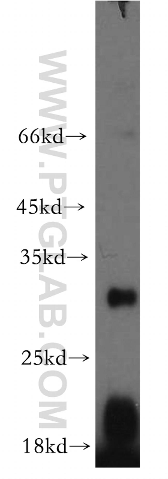 EBI3 Antibody in Western Blot (WB)