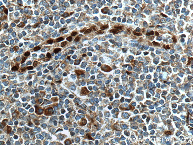 IL33 Antibody in Immunohistochemistry (Paraffin) (IHC (P))