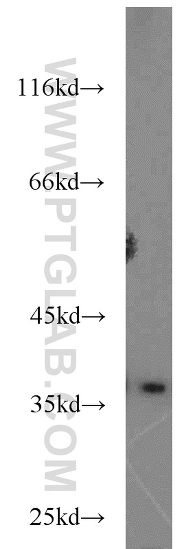 IL33 Antibody in Western Blot (WB)