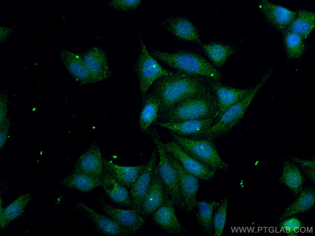 COX2 Antibody in Immunocytochemistry (ICC/IF)