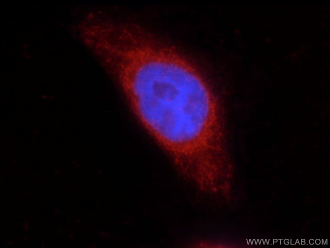 COX2 Antibody in Immunocytochemistry (ICC/IF)