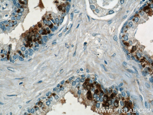 COX2 Antibody in Immunohistochemistry (Paraffin) (IHC (P))