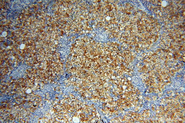 COX2 Antibody in Immunohistochemistry (Paraffin) (IHC (P))