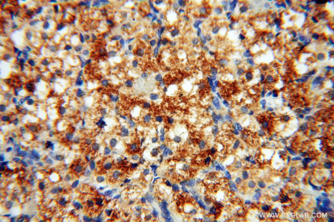 COX2 Antibody in Immunohistochemistry (Paraffin) (IHC (P))