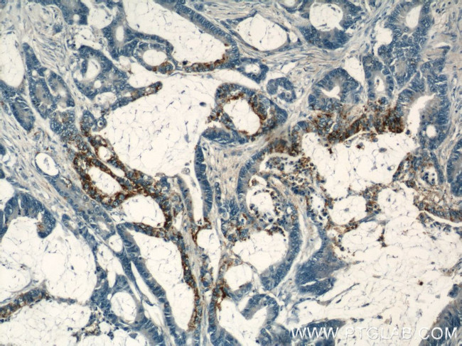 COX2 Antibody in Immunohistochemistry (Paraffin) (IHC (P))