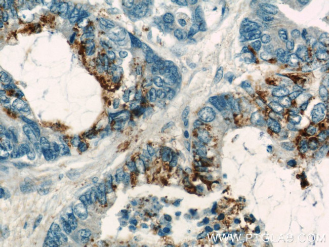 COX2 Antibody in Immunohistochemistry (Paraffin) (IHC (P))